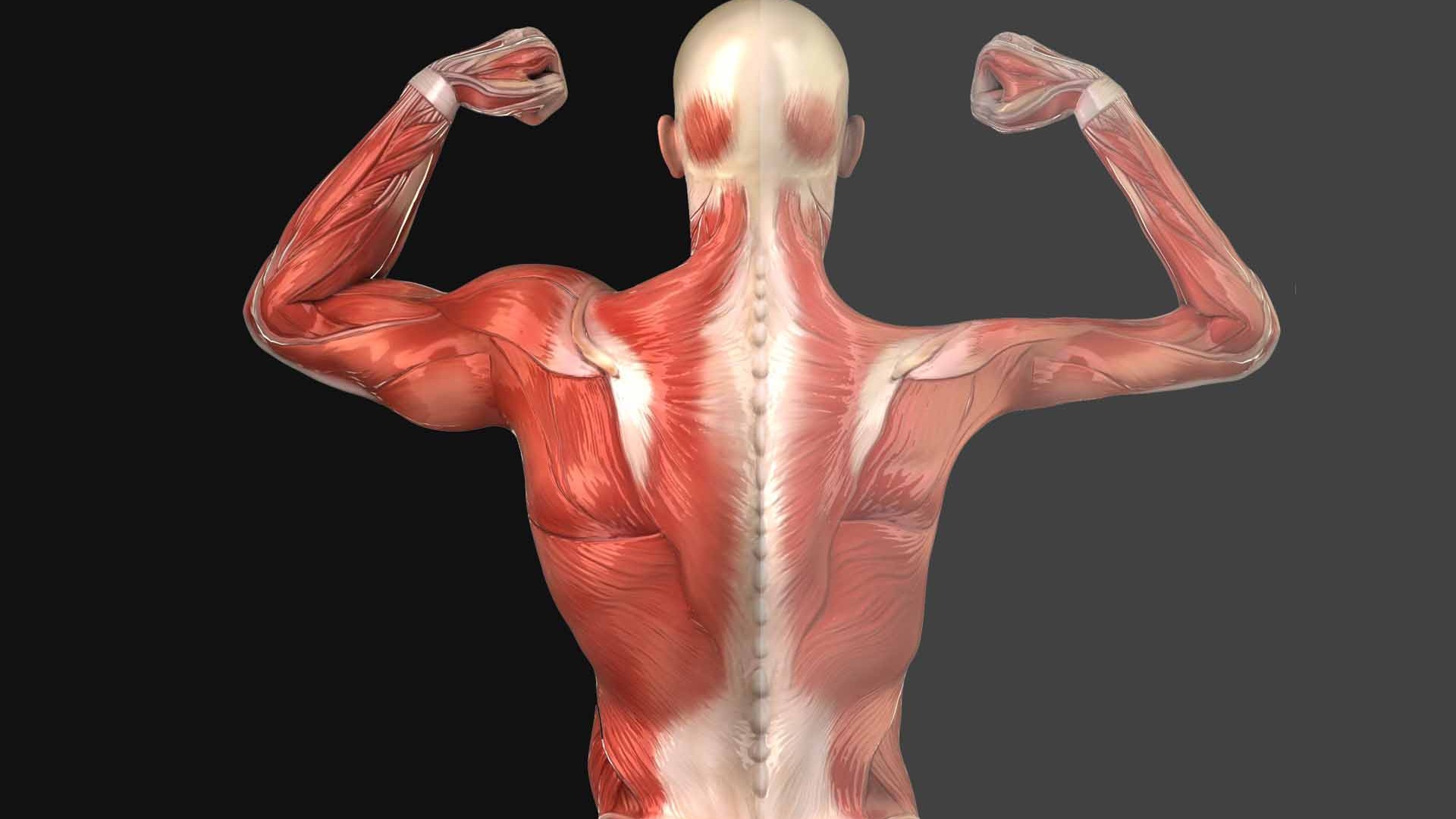 Миотоническая дистрофия 2 типа