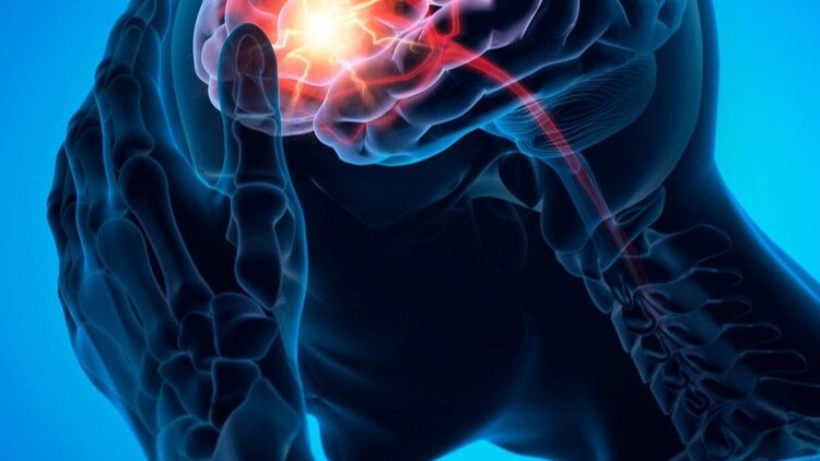 Мигренеподобные головные боли