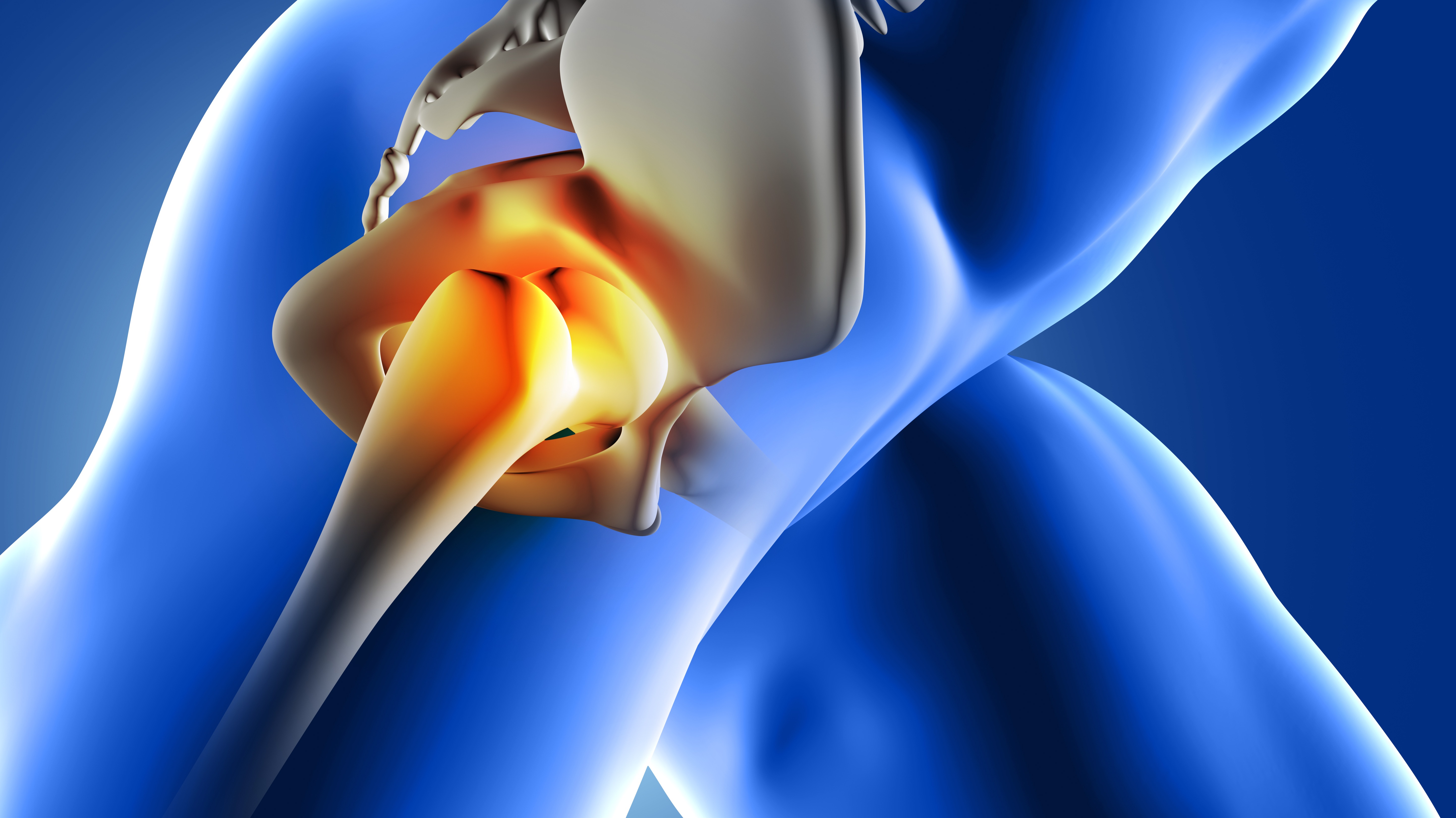 Болезнь Легга–Кальве–Пертеса