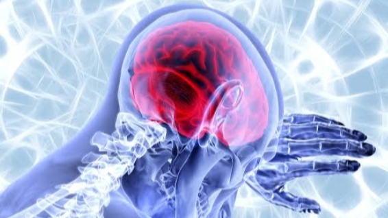 Гипническая головная боль