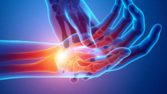 Синдром запястного канала